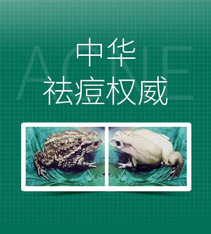 珈黛——中华祛痘专家